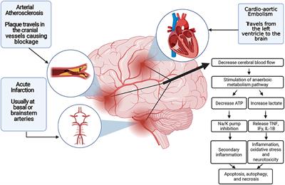 Neuroprotection in Acute Ischemic Stroke: A Battle Against the Biology of Nature